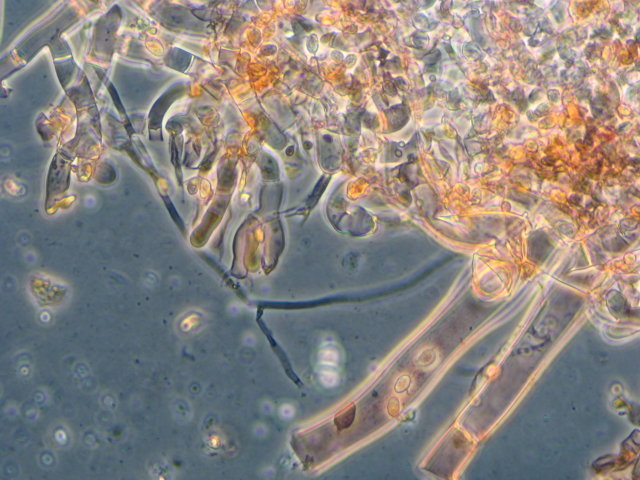 Botryobasidium con spore finemente verrucose